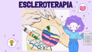 Reducción Tumor Niño Arequipa: Innovación Sin Cirugía Agresiva